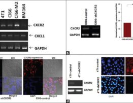 CXCR2 expression in parent, vector control and CXCR2 knock-down cells