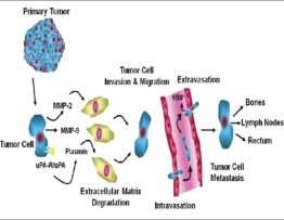 Multistep metastatic process of prostate cancer cells