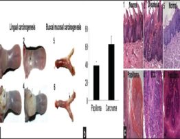 (a) Rat model of oral carcinogenesis. A. Morphology of (1) vehicle treated tongue,