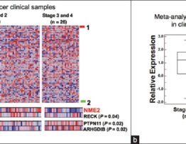 Expression analyses suggested NM23 H2 as a candidate biomarker metastasis