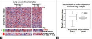 Expression analyses suggested NM23 H2 as a candidate biomarker metastasis