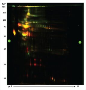 Typical difference in-gel electrophoresis gel image