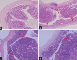 Histological images of the colonic mucosa of azoxymethane