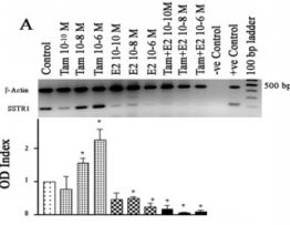 Differential regulation of somatostatin receptors 1 and 2 mRNA and protein expression by tamoxifen and estradiol in breast cancer cells
