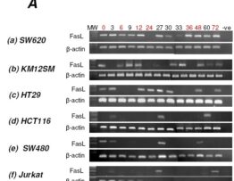Fas ligand expression in human and mouse cancer cell lines; a caveat on over-reliance on mRNA data