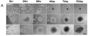 α2β1 integrin affects metastatic potential of ovarian carcinoma spheroids by supporting disaggregation and proteolysis