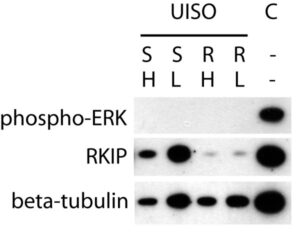 RKIP does not contribute to MAP kinase pathway silencing in the Merkel Cell Carcinoma cell line UISO